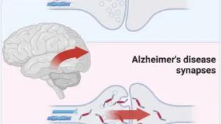 Alzheimer's diagram 