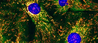 Colourful image of mitochondria seen through a microscope