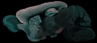Mouse brain showing red areas where protein exchange occurs most slowly. 