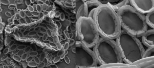 Electron microscopy image of Chrysotila carterae