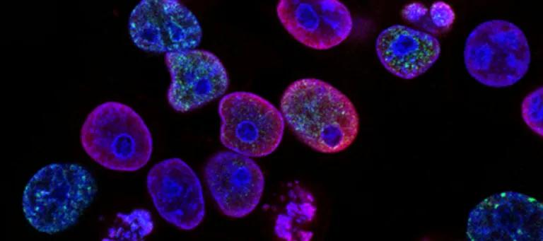cells being imaged