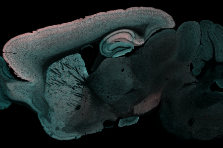 Mouse brain showing red areas where protein exchange occurs most slowly. 