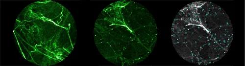 Bacterial Imaging Probe