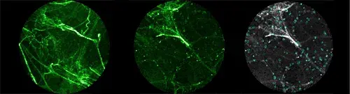 Bacterial Imaging Probe