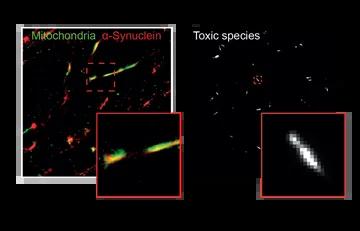 Molecular Mechanisms of Parkinson’s