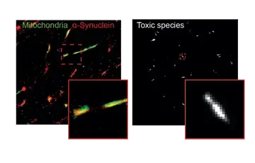 Molecular Mechanisms of Parkinson’s