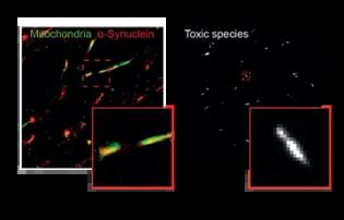 Molecular Mechanisms of Parkinson’s