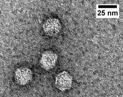 Characterising Bacterial Encapsulins
