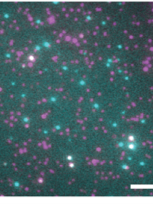 Magenta spots show old protein in complexes, whereas blue is the new protein. 