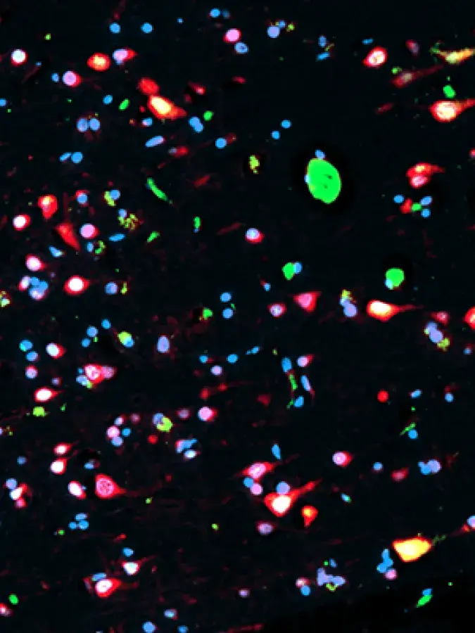 horrocks-cells